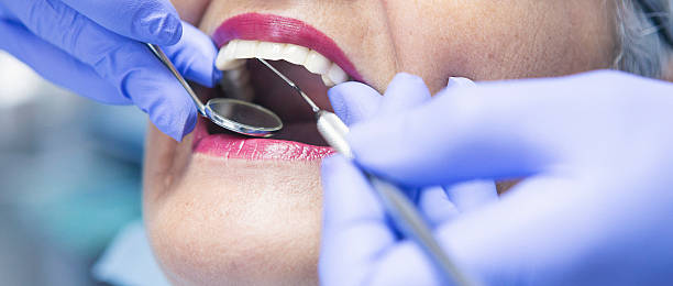 Best Emergency Treatment for Dental Infections or Abscesses in Timber Pines, FL